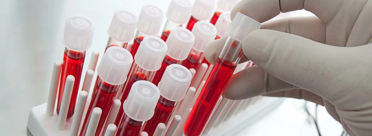 چرا آزمایش خون برای همه الزامی است؟ + بررسی انواع و اهمیت تست خون