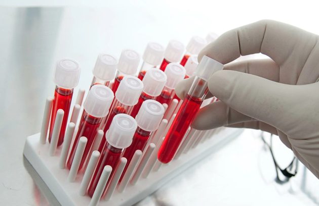 چرا آزمایش خون برای همه الزامی است؟ + بررسی انواع و اهمیت تست خون