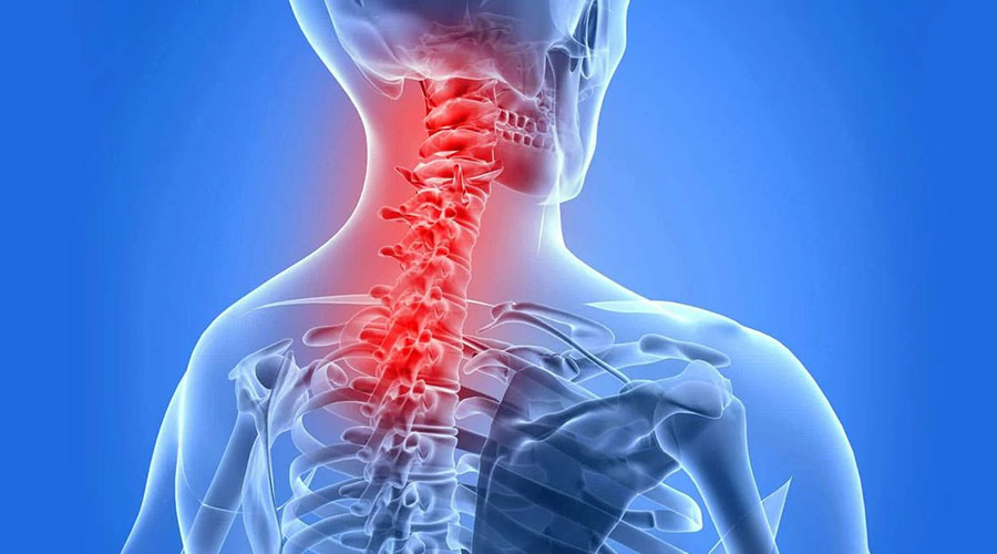 شایع‌ترین دلایل آرتروز گردن و دیسک گردن چیست؟