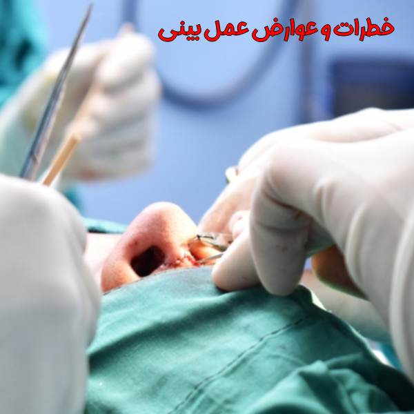 عمل بینی برای چه کسانی خطرناک است؟