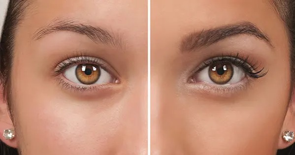 کاشت ابرو در مشهد