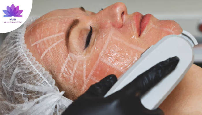 کدام روش جوانسازی مناسب من است؟